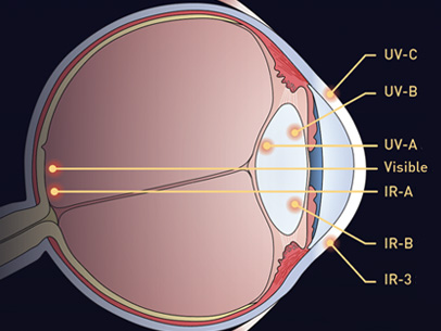 Lasers & the Human Eye