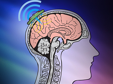 Cartoon of device on skull with brain