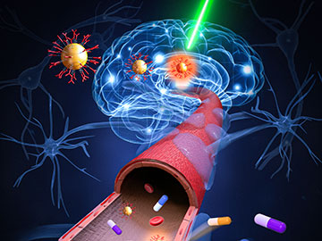 Lasers and Nanoparticles Open Blood–Brain Barrier