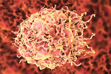 Colon cancer cell